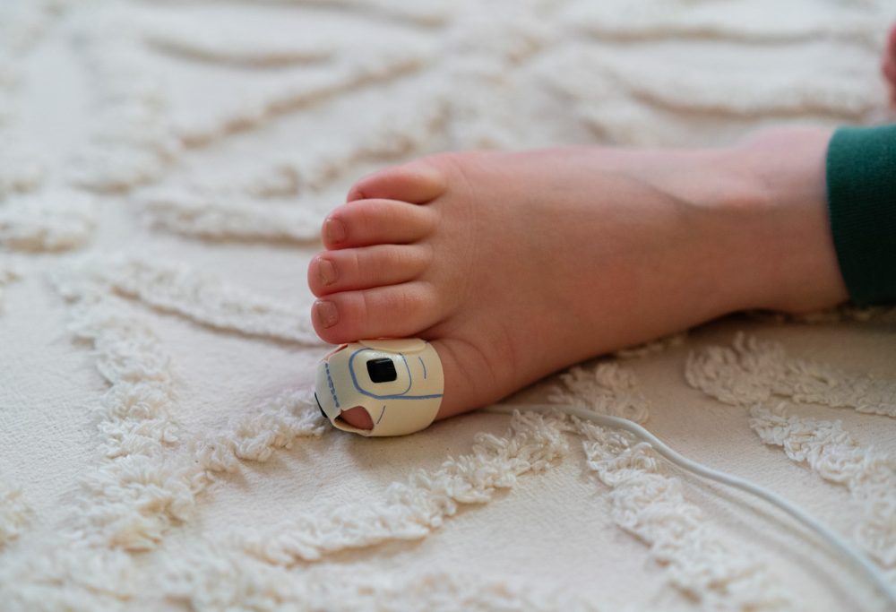 A photograph of a Snap Diagnostics pediatric oximetry sensor